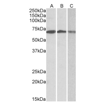 Western Blot - Anti-OAS2 Antibody (A82575)