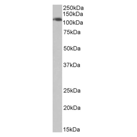 Western Blot - Anti-AP-2 Complex Subunit alpha-1 Antibody (A82576) - Antibodies.com