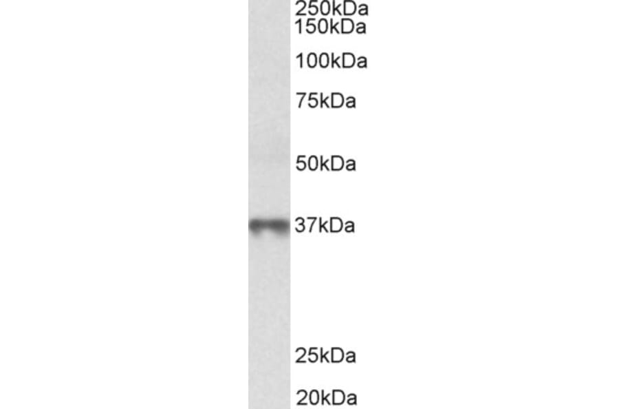 Western Blot - Anti-MAT2B/TGR Antibody (A82578) - Antibodies.com