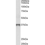 Western Blot - Anti-MAT2B/TGR Antibody (A82578) - Antibodies.com