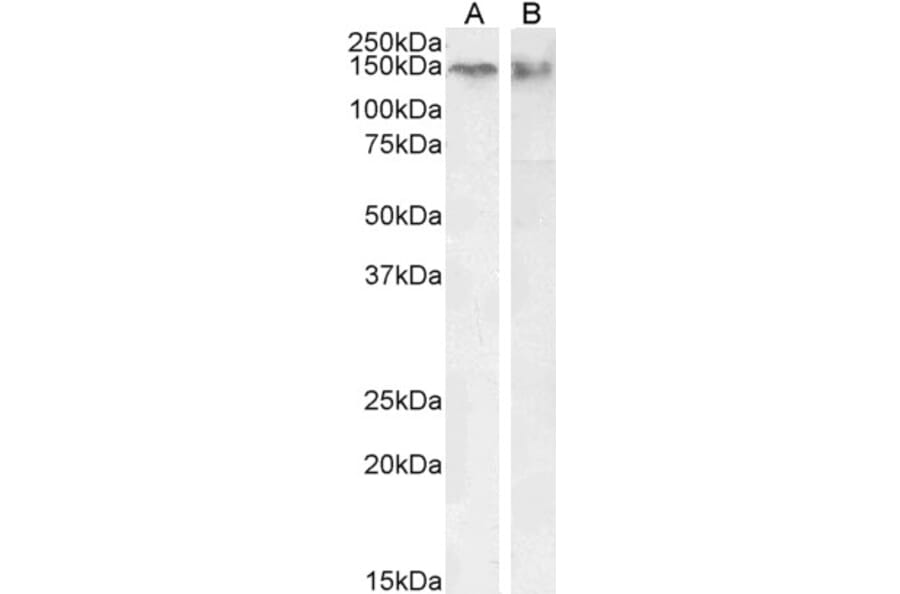 Western Blot - Anti-CTCF Antibody (A82579) - Antibodies.com