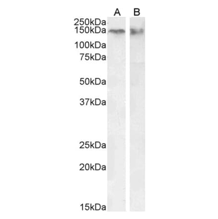 Western Blot - Anti-CTCF Antibody (A82579) - Antibodies.com