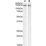 Western Blot - Anti-CTCF Antibody (A82579) - Antibodies.com