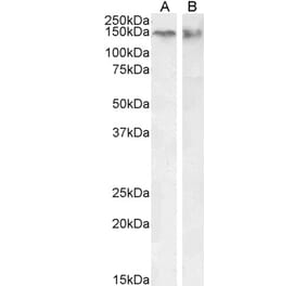 Western Blot - Anti-CTCF Antibody (A82579) - Antibodies.com