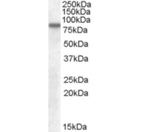 Western Blot - Anti-LIMPII Antibody (A82581) - Antibodies.com