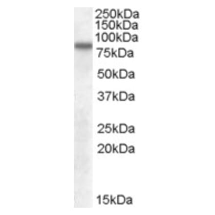 Western Blot - Anti-LIMPII Antibody (A82581) - Antibodies.com