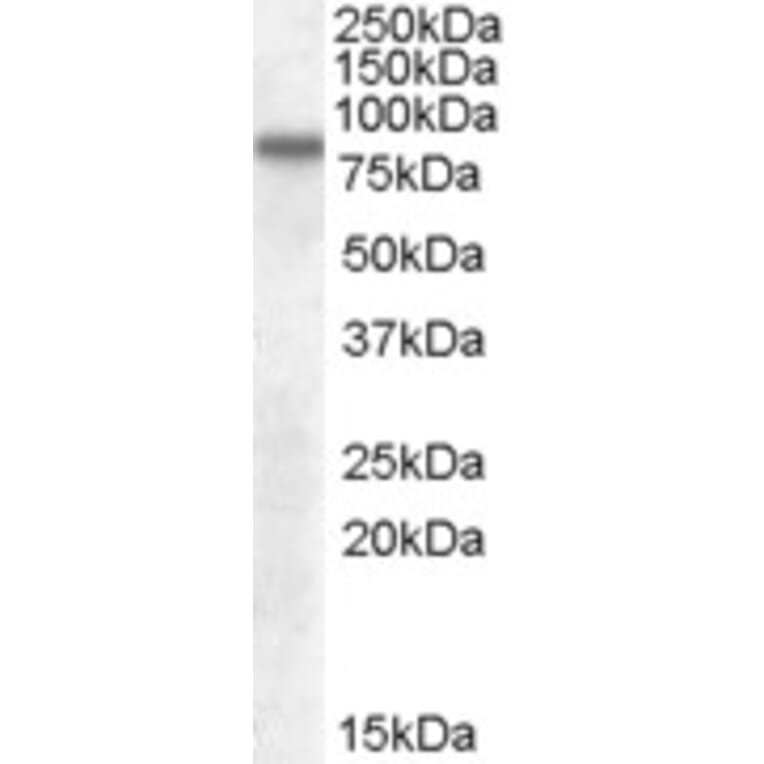 Western Blot - Anti-LIMPII Antibody (A82581) - Antibodies.com