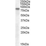 Western Blot - Anti-LIMPII Antibody (A82581) - Antibodies.com