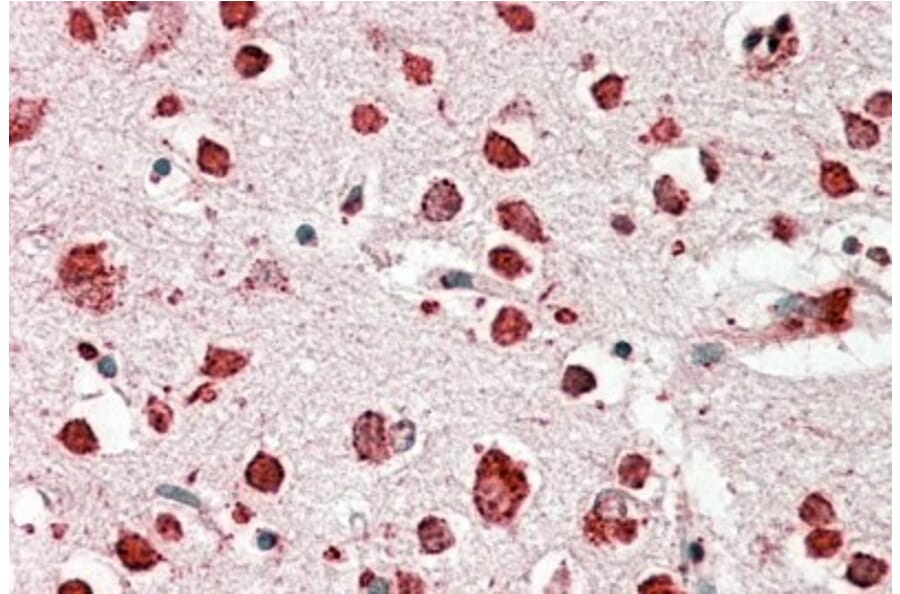 Immunohistochemistry - Anti-LIMPII Antibody (A82581) - Antibodies.com