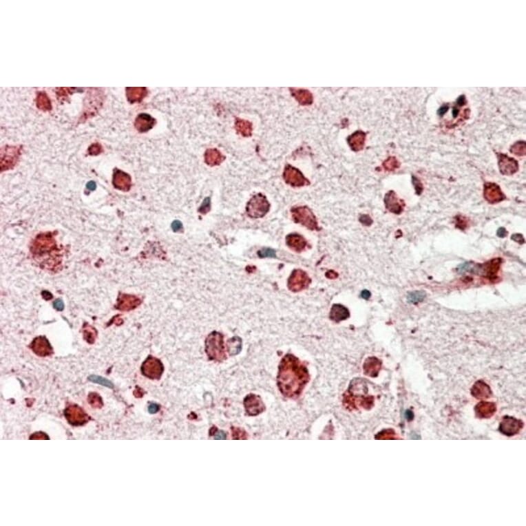 Immunohistochemistry - Anti-LIMPII Antibody (A82581) - Antibodies.com