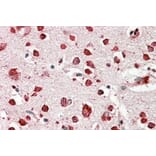 Immunohistochemistry - Anti-LIMPII Antibody (A82581) - Antibodies.com