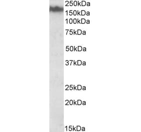 Western Blot - Anti-160 kD Neurofilament Medium Antibody (A82582) - Antibodies.com