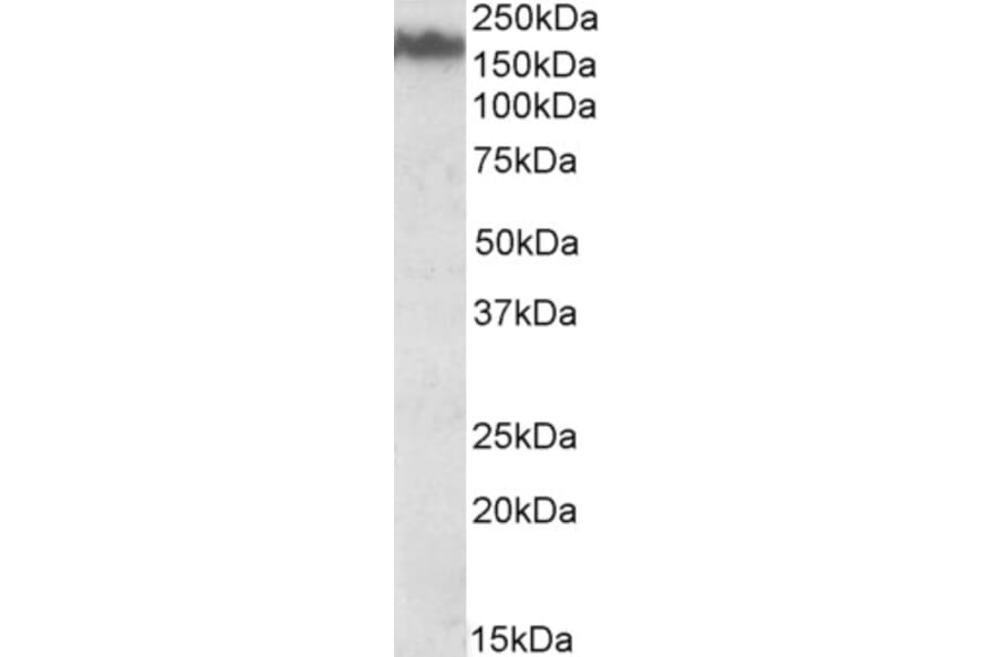 Western Blot - Anti-160 kD Neurofilament Medium Antibody (A82582) - Antibodies.com