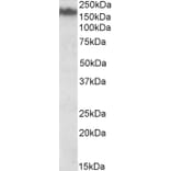Western Blot - Anti-160 kD Neurofilament Medium Antibody (A82582) - Antibodies.com