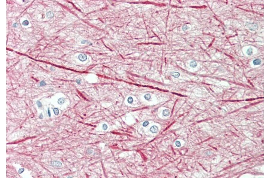 Immunohistochemistry - Anti-160 kD Neurofilament Medium Antibody (A82582) - Antibodies.com
