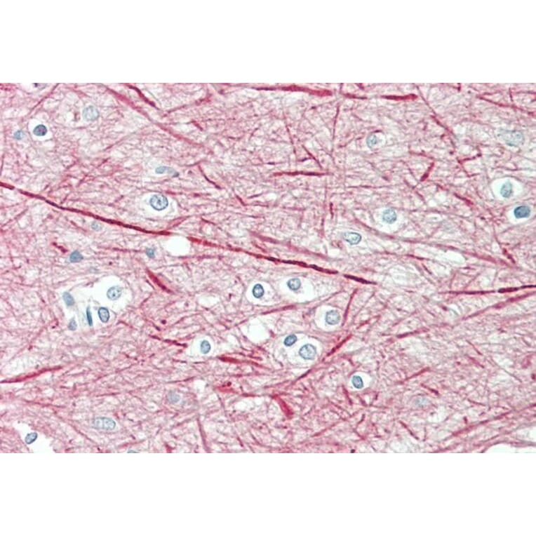 Immunohistochemistry - Anti-160 kD Neurofilament Medium Antibody (A82582) - Antibodies.com