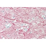 Immunohistochemistry - Anti-160 kD Neurofilament Medium Antibody (A82582) - Antibodies.com