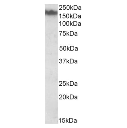 Western Blot - Anti-NEFM Antibody (A82582) - Antibodies.com