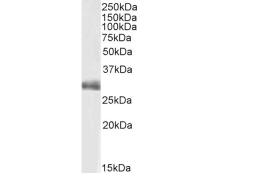 Western Blot - Anti-FGF5 Antibody (A82583) - Antibodies.com