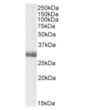 Western Blot - Anti-FGF5 Antibody (A82583) - Antibodies.com