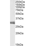 Western Blot - Anti-FGF5 Antibody (A82583) - Antibodies.com