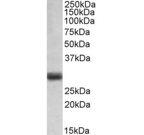 Western Blot - Anti-FGF5 Antibody (A82583) - Antibodies.com