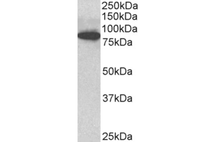 Western Blot - Anti-Cenexin1/ODF2 Antibody (A82584) - Antibodies.com