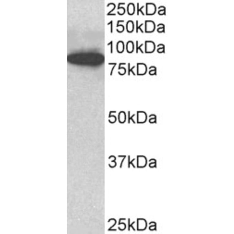 Western Blot - Anti-Cenexin1/ODF2 Antibody (A82584) - Antibodies.com