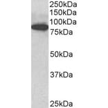 Western Blot - Anti-Cenexin1/ODF2 Antibody (A82584) - Antibodies.com