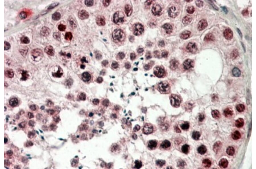 Immunohistochemistry - Anti-CIRP Antibody (A82585) - Antibodies.com