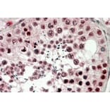 Immunohistochemistry - Anti-CIRP Antibody (A82585) - Antibodies.com
