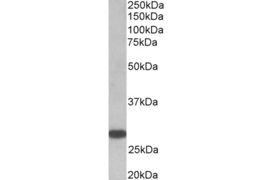 Western Blot - Anti-TSH Receptor/TSH-R Antibody (A82587) - Antibodies.com