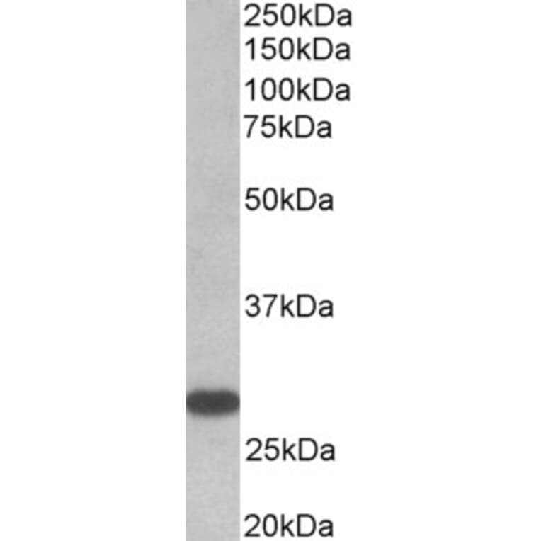 Western Blot - Anti-TSH Receptor/TSH-R Antibody (A82587) - Antibodies.com