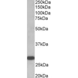 Western Blot - Anti-TSH Receptor/TSH-R Antibody (A82587) - Antibodies.com
