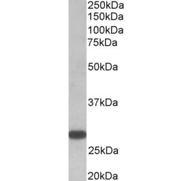 Western Blot - Anti-TSHR Antibody (A82587) - Antibodies.com