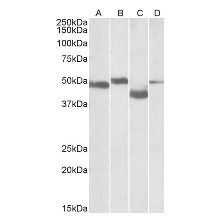 Western Blot - Anti-MEIS2 Antibody (A82588) - Antibodies.com