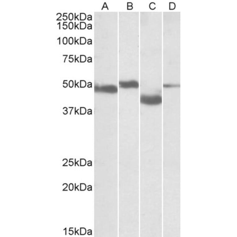 Western Blot - Anti-MEIS2 Antibody (A82588) - Antibodies.com
