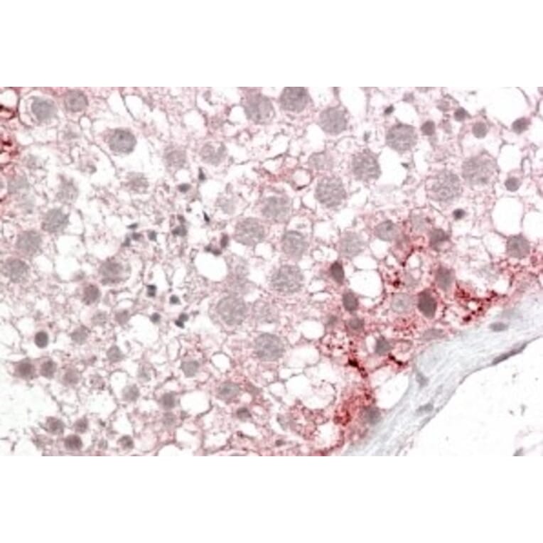 Immunohistochemistry - Anti-PMP70 Antibody (A82590) - Antibodies.com