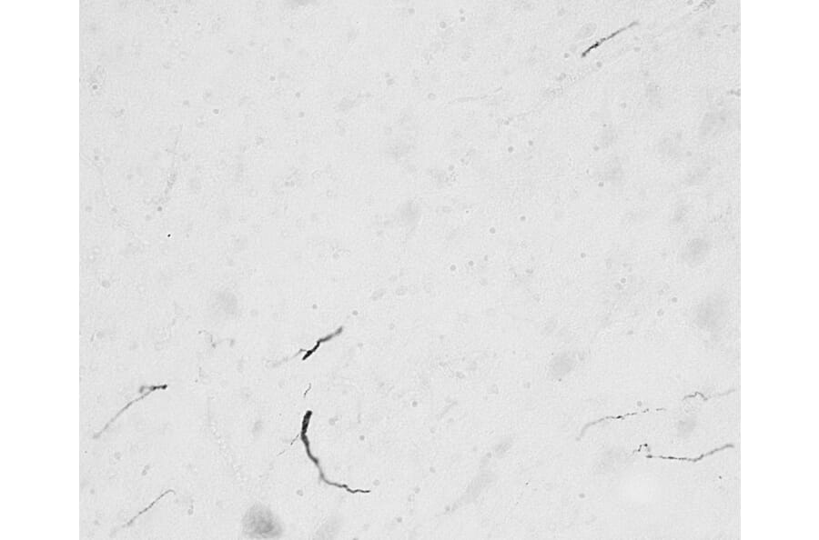 Immunohistochemistry - Anti-FGF14 Antibody (A82593) - Antibodies.com
