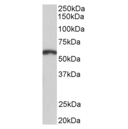 Western Blot - Anti-PAX3 Antibody (A82594) - Antibodies.com