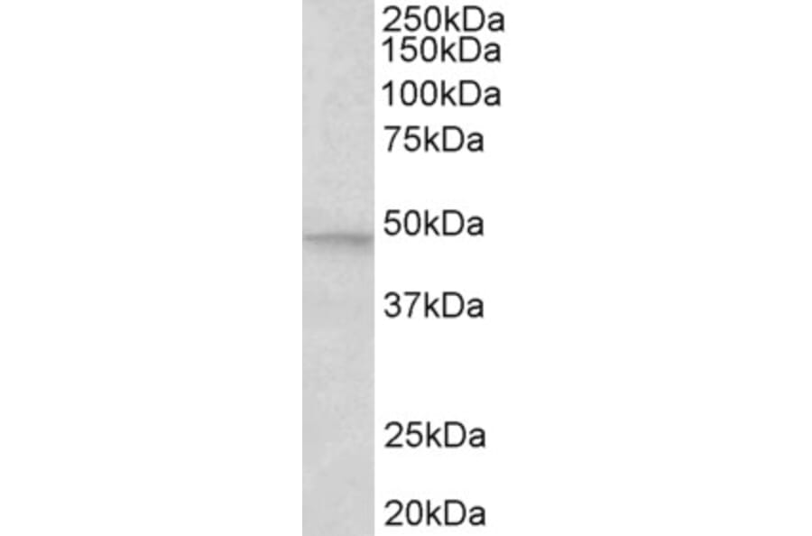 Western Blot - Anti-JNK2 beta Antibody (A82595) - Antibodies.com