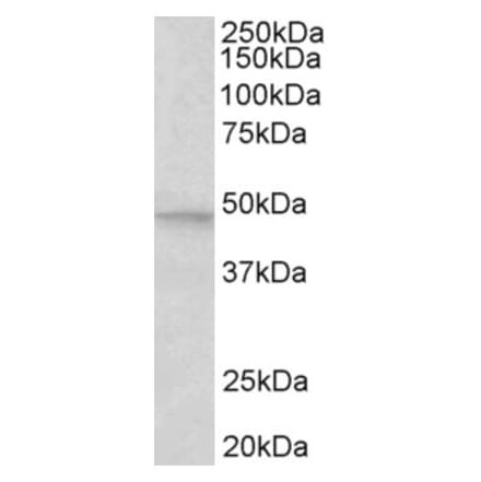 Western Blot - Anti-JNK2 beta Antibody (A82595) - Antibodies.com