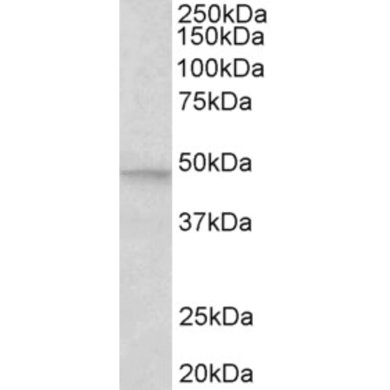 Western Blot - Anti-JNK2 beta Antibody (A82595) - Antibodies.com