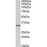 Western Blot - Anti-NHERF-2/SIP-1 Antibody (A82596) - Antibodies.com