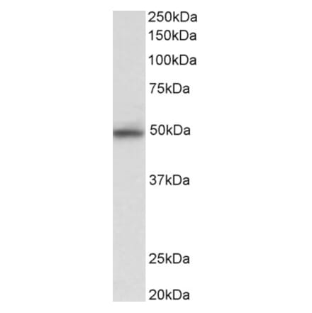 Western Blot - Anti-JNK2 alpha Antibody (A82597) - Antibodies.com