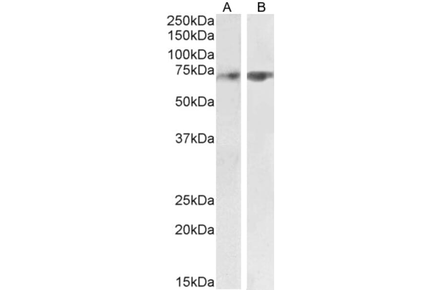 Western Blot - Anti-SYVN1/HRD1 Antibody (A82599) - Antibodies.com