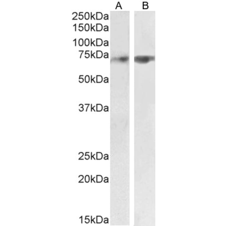 Western Blot - Anti-SYVN1/HRD1 Antibody (A82599) - Antibodies.com