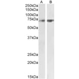 Western Blot - Anti-SYVN1/HRD1 Antibody (A82599) - Antibodies.com