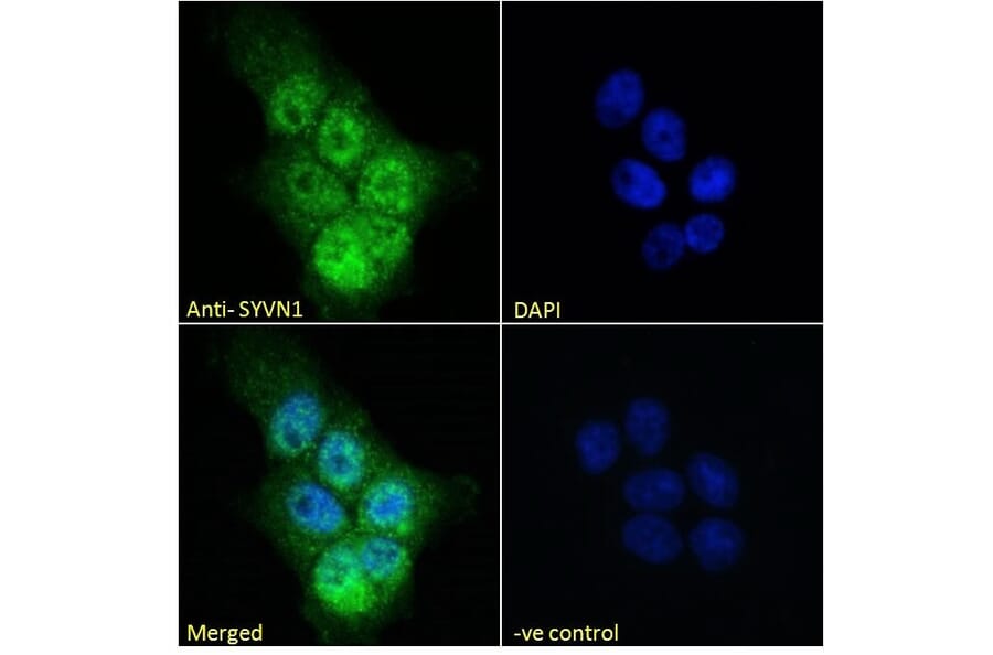 Immunofluorescence - Anti-SYVN1/HRD1 Antibody (A82599) - Antibodies.com