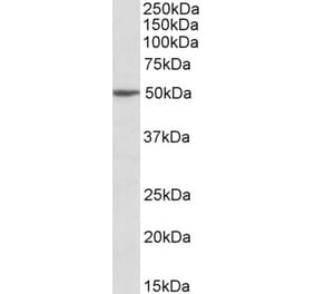 Western Blot - Anti-MON1A Antibody (A82601) - Antibodies.com